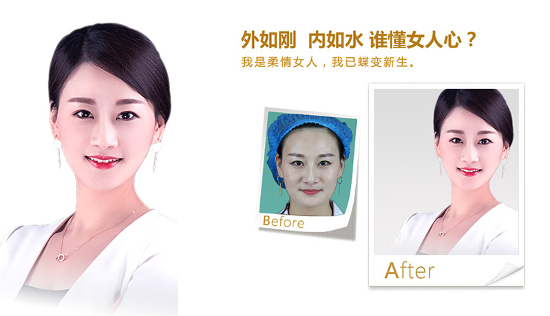 台南V脸、线雕隆鼻